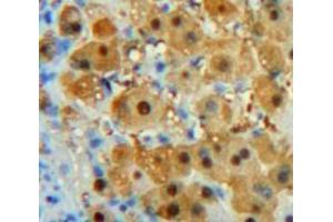 Used in DAB staining on fromalin fixed paraffin-embedded Liver tissue (PDGFC 抗体  (AA 23-345))