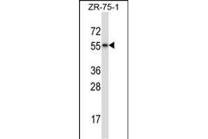 RORB Antibody (C-term) (ABIN657975 and ABIN2846921) western blot analysis in ZR-75-1 cell line lysates (35 μg/lane). (RORB 抗体  (C-Term))