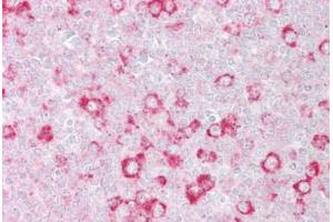 Anti-RHOD antibody IHC staining of human tonsil. (RHOD 抗体  (C-Term))