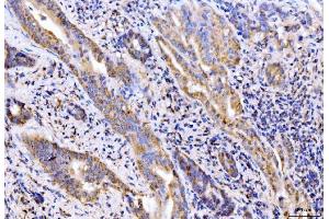 IHC analysis of Giantin/GOLGB1 using anti-Giantin/GOLGB1 antibody (ABIN7600139).