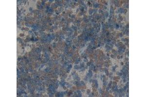 Used in DAB staining on fromalin fixed paraffin- embedded Kidney tissue (KLRK1 抗体  (AA 75-215))