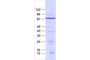 Western Blotting (WB) image for General Transcription Factor IIA, 1-Like (GTF2A1L) protein (His tag) (ABIN2722302)