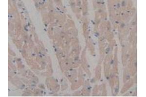 IHC-P analysis of Mouse Heart Tissue, with DAB staining. (MAP6 抗体  (AA 177-387))