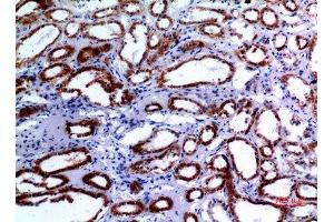 Immunohistochemistry (IHC) analysis of paraffin-embedded Human Kidney, antibody was diluted at 1:100. (XRCC6 抗体  (Ser408))