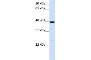 ADH1A antibody used at 1 ug/ml to detect target protein. (ADH1A 抗体)