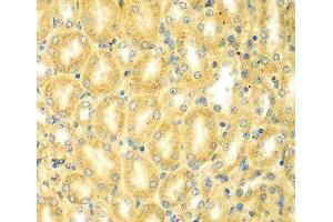 Immunohistochemistry of paraffin-embedded Mouse kidney using PDE4DIP Polyclonal Antibody at dilution of 1:100 (40x lens). (PDE4DIP 抗体)