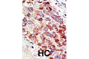 Immunohistochemistry (IHC) image for anti-Cbl proto-oncogene C (CBLC) antibody (ABIN2996831) (CBLC 抗体)