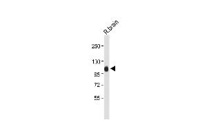 Anti-G Antibody (Center) at 1:2000 dilution + Rat brain whole tissue lysate Lysates/proteins at 20 μg per lane. (MAG 抗体  (AA 439-466))