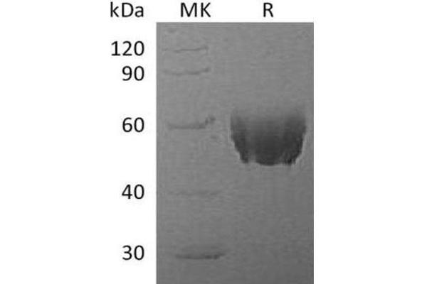 Fetuin A Protein (His tag)