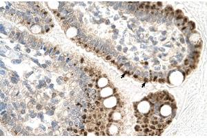 Rabbit Anti-ZFP1 Antibody Catalog Number: ARP31586 Paraffin Embedded Tissue: Human Intestine Cellular Data: Epithelial cells of intestinal villas Antibody Concentration: 4. (Zfp-1 抗体  (N-Term))