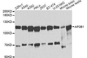 Western blot analysis of extracts of various cell lines, using AP2B1 antibody (ABIN1871002) at 1:1000 dilution. (AP2B1 抗体)