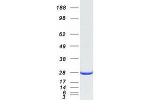 Western Blotting (WB) image for Nipsnap Homolog 3A (NIPSNAP3A) protein (Myc-DYKDDDDK Tag) (ABIN2727326)