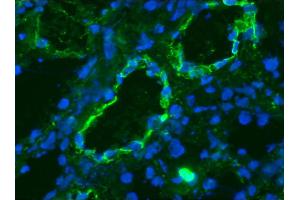 Image no. 2 for anti-K-Cadherin (CDH6) antibody (ABIN335402) (CDH6 抗体)