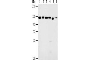 Gel: 6 % SDS-PAGE, Lysate: 40 μg, Lane 1-6: 293T cells, K562 cells, hela cells, 231 cells, Jurkat cells, NIH/3T3 cells, Primary antibody: ABIN7130189(MATR3 Antibody) at dilution 1/500, Secondary antibody: Goat anti rabbit IgG at 1/8000 dilution, Exposure time: 3 seconds (MATR3 抗体)