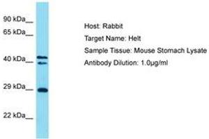Image no. 1 for anti-Helt BHLH Transcription Factor (HELT) (AA 138-187) antibody (ABIN6750287) (HELT 抗体  (AA 138-187))