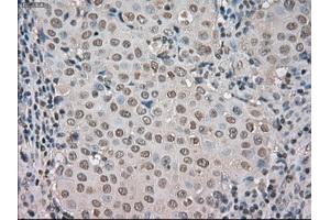 Image no. 3 for anti-Budding Uninhibited By Benzimidazoles 1 Homolog beta (Yeast) (BUB1B) antibody (ABIN1497000) (BUB1B 抗体)