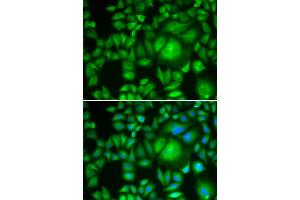 Immunofluorescence analysis of HeLa cells using CBR1 antibody (ABIN5973163). (CBR1 抗体)