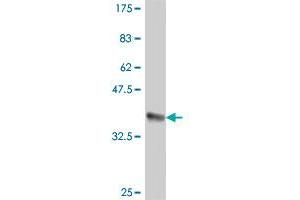 Western Blot detection against Immunogen (36. (GIPC1 抗体  (AA 61-158))