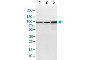 Western blot analysis of Lane 1: NIH-3T3 cell lysate, Lane 2: NBT-II cell lysate, Lane 3: PC12 cell lysate with ACO2 polyclonal antibody . (ACO2 抗体  (AA 544-693))