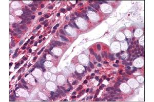 Immunohistochemistry Image: Human Small Intestine: Formalin-Fixed, Paraffin-Embedded (FFPE) (Serotonin Receptor 3A 抗体  (Internal Region))
