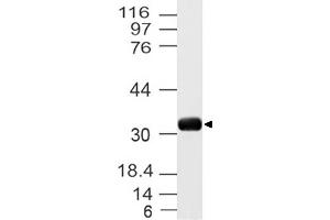 Image no. 1 for anti-Uncoupling Protein 3 (Mitochondrial, Proton Carrier) (UCP3) (AA 1-300) antibody (ABIN5027619) (UCP3 抗体  (AA 1-300))