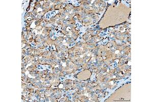 IHC analysis of SIAE using anti-SIAE antibody (ABIN7600774).