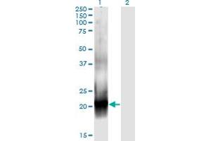 Western Blotting (WB) image for anti-Ras-Related C3 Botulinum Toxin Substrate 2 (Rho Family, Small GTP Binding Protein Rac2) (RAC2) (AA 1-192) antibody (ABIN519594)