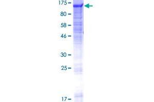 Image no. 1 for Glucosidase, Alpha, Neutral C (GANC) (AA 1-914) protein (GST tag) (ABIN1354781) (GANC Protein (AA 1-914) (GST tag))