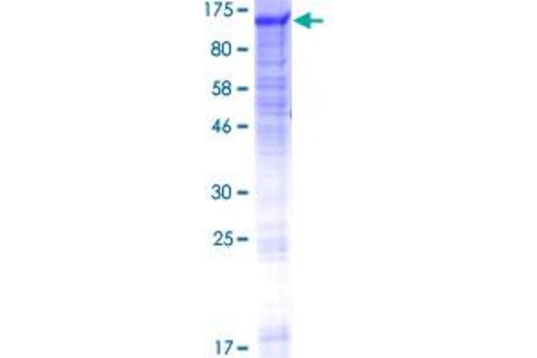 GANC Protein (AA 1-914) (GST tag)