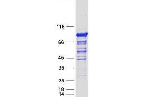 Western Blotting (WB) image for Oxysterol Binding Protein-Like 11 (OSBPL11) protein (Myc-DYKDDDDK Tag) (ABIN2727983)