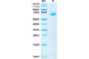 SDS-PAGE (SDS) image for Programmed Cell Death 1 (PDCD1) (AA 25-167) protein (Fc Tag) (ABIN7275423)