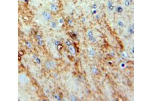 Used in DAB staining on fromalin fixed paraffin-embedded Brain tissue (NMS 抗体  (AA 31-153))