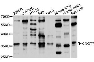 Western blot analysis of extracts of various cell lines, using CNOT7 antibody (ABIN5995835) at 1/1000 dilution. (CNOT7 抗体)