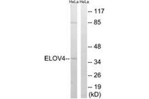 Western Blotting (WB) image for anti-ELOVL Fatty Acid Elongase 4 (ELOVL4) (AA 41-90) antibody (ABIN2890303) (ELOVL4 抗体  (AA 41-90))