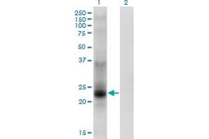 Western Blot analysis of TSPAN8 expression in transfected 293T cell line by TSPAN8 monoclonal antibody (M02), clone 1E5.