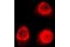 Immunofluorescent analysis of Uev1A staining in U2OS cells. (UBE2V1 抗体)