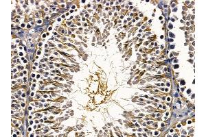 ABIN6257296 and ABIN6275747 at 1/100 staining rat testis tissue by IHC-P. (TAO Kinase 3 抗体  (Internal Region))