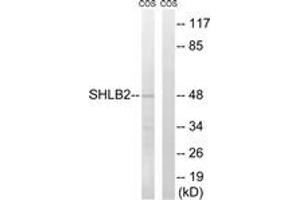 Western blot analysis of extracts from COS7 cells, using SH3GLB2 Antibody. (SH3GLB2 抗体  (AA 131-180))