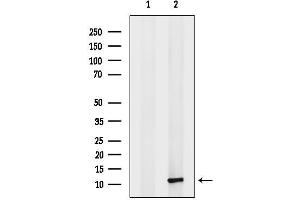 anti-Chemokine (C-C Motif) Ligand 13 (CCL13) (Internal Region) antibody