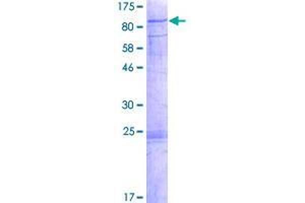 CDKL3 Protein (AA 1-592) (GST tag)
