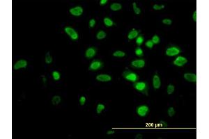 Immunofluorescence of monoclonal antibody to AKT2 on HeLa cell. (AKT2 抗体  (AA 100-189))
