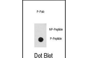 Dot blot analysis of anti-Phospho-CDK2-pT14 Antibody (ABIN389996 and ABIN2839773) on nitrocellulose membrane. (CDK2 抗体  (pThr14))