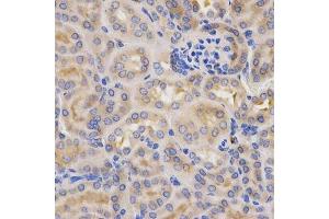 Immunohistochemistry (Paraffin-embedded Sections) (IHC (p)) image for anti-Complement Factor B (CFB) (AA 80-420) antibody (ABIN3015550)
