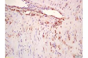 Formalin-fixed and paraffin embedded human myometrium labeled with Anti-phospho-ERK5 (Ser496) Polyclonal Antibody, Unconjugated (ABIN710246) at 1:200 followed by conjugation to the secondary antibody and DAB staining (MAPK7 抗体  (pSer496))