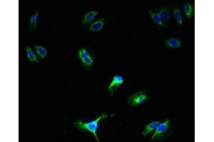 Immunofluorescent analysis of HepG2 cells using ABIN7168735 at dilution of 1:100 and Alexa Fluor 488-congugated AffiniPure Goat Anti-Rabbit IgG(H+L) (SCAMP5 抗体  (AA 170-235))