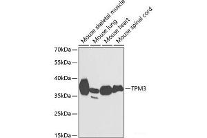 Western blot analysis of extracts of various cell lines using TPM3 Polyclonal Antibody at dilution of 1:1000. (TPM3 抗体)