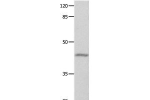 Western Blot analysis of Mouse eyes tissue using GNA11 Polyclonal Antibody at dilution of 1:550 (GNA11 抗体)