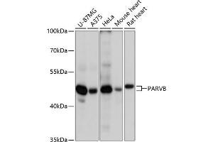 Western blot analysis of extracts of various cell lines, using PARVB antibody (ABIN6127617, ABIN6145244, ABIN6145245 and ABIN6217054) at 1:3000 dilution. (Parvin, beta 抗体  (AA 1-100))