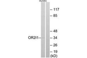 Western blot analysis of extracts from HuvEc cells, using OR2I1 Antibody. (OR2I1P 抗体  (AA 261-310))