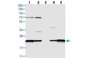 Western blot analysis of Lane 1: RT-4, Lane 2: U-251 MG, Lane 3: Human Plasma, Lane 4: Liver, Lane 5: Tonsil with SPCS2 polyclonal antibody  at 1:250-1:500 dilution. (SPCS2 抗体)